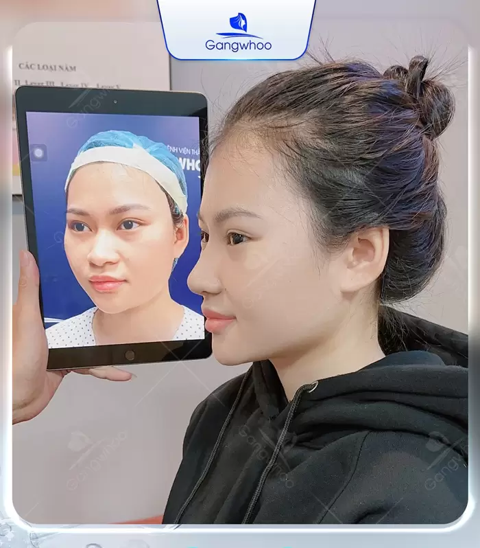 en nang mui sun surgiform 10