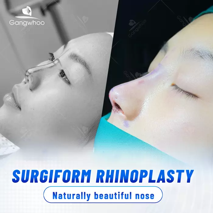 en nang mui sun surgiform 4