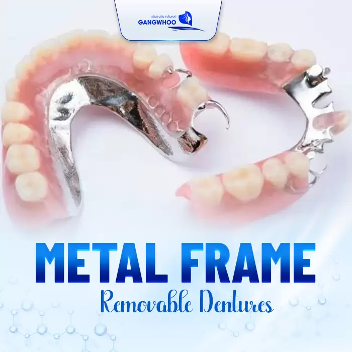 All About Removable Denture Restoration 5 en phuc hoi rang gia 3