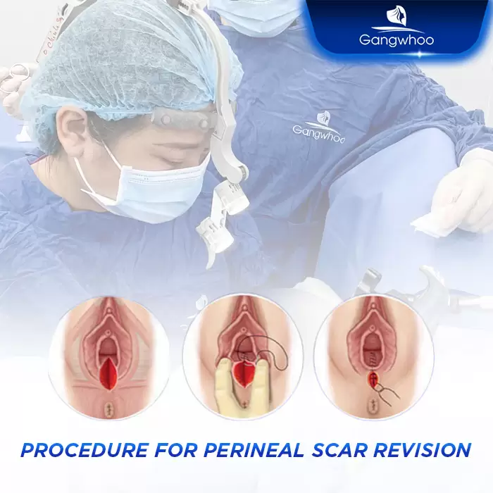 en sua seo tang sinh mon 1