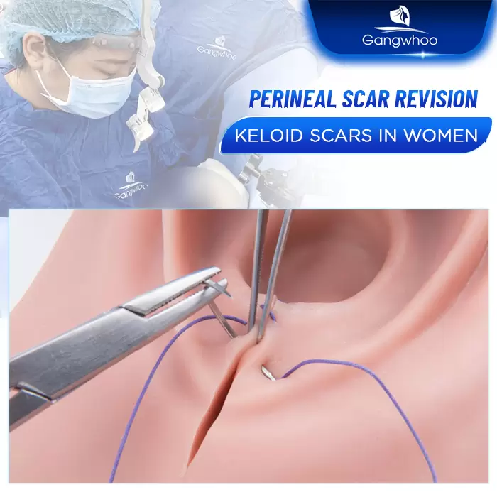 en sua seo tang sinh mon 3