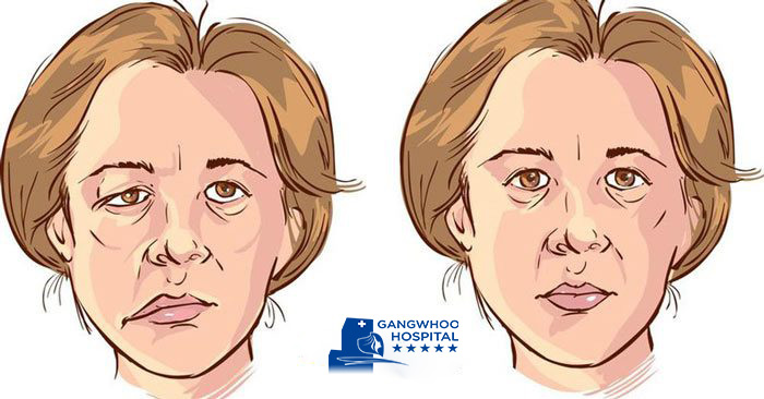 enliet day tahn kinh so 7 bvtm gangwhoo 1