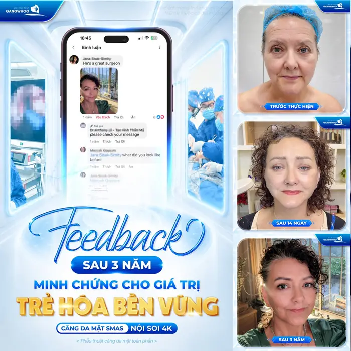 TOP 10 Địa Chỉ Căng Da Mặt Uy Tín Tại TP Hồ Chí Minh 7 Feedback sau 3 năm minh chứng cho giá trị trẻ hóa bền vững sau căng da mặt Smas nội soi 4K