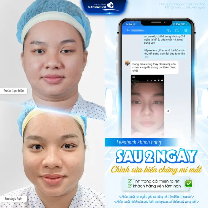 fb sua bien chung mi mat sau 2 ngay da danh loi khen vi su cai thien da bieu hien thay to