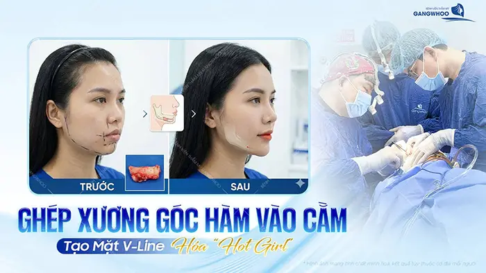 ghep xuong goc ham vao cam