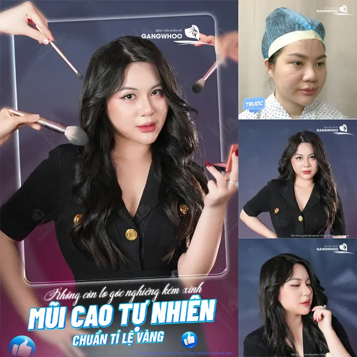 Khoe nhẹ góc nghiêng cao đẹp chuẩn tỉ lệ vàng khách hàng hài lòng với diện mạo mới