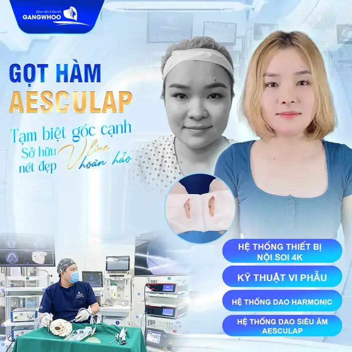 Bảng Giá Gọt Hàm Bao Nhiêu Tiền? Bảng Giá Mới - 2025 12 Bảng Giá Gọt Hàm Bao Nhiêu Tiền? Bảng Giá Mới - 2025