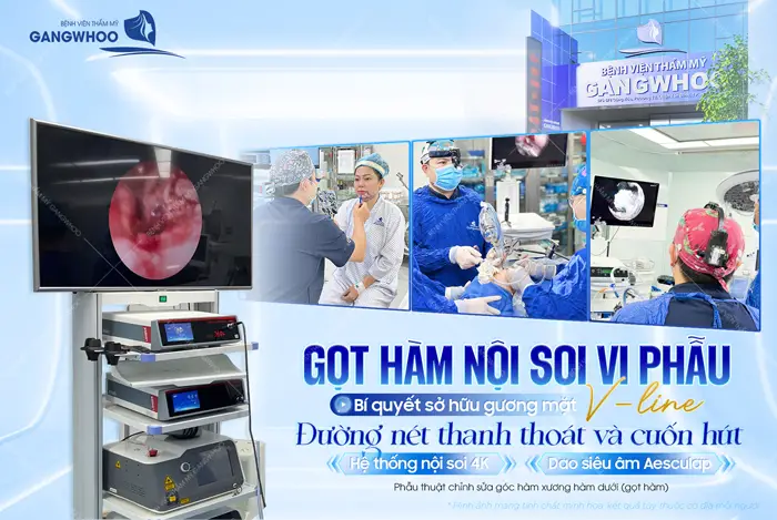 Gọt hàm nội soi vi phẫu bí quyết sở hữu gương mặt đẹp V Line tôn đường nét thanh thoát và cuốn hút cho diện mạo