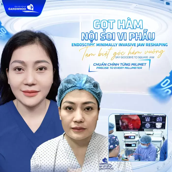 Giới Thiệu Bệnh Viện Thẩm Mỹ Gangwhoo - Bệnh viện Chuẩn Hàn 14 got ham noi soi vi phau tam biet goc ham vuong hieu qua