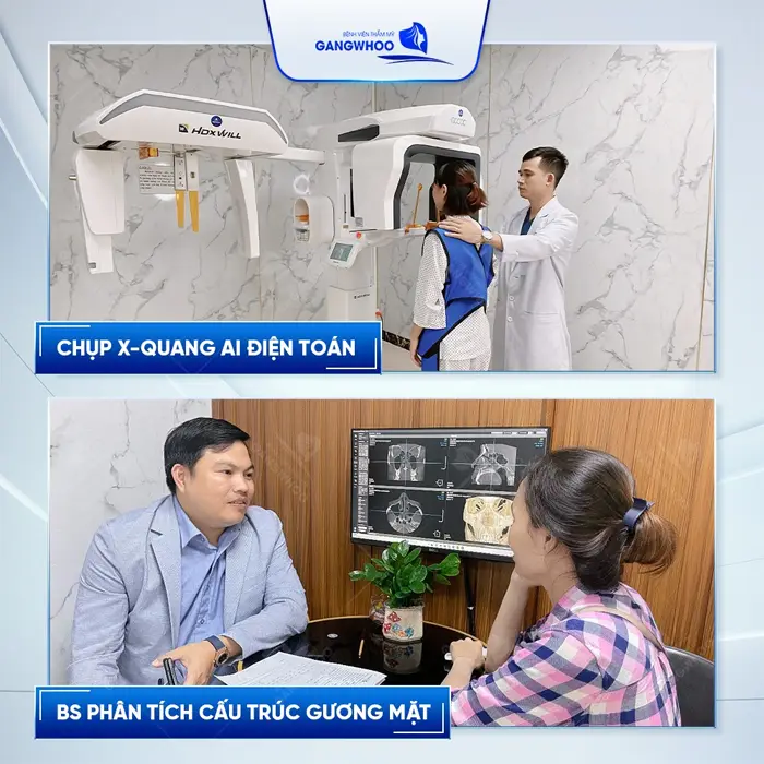 Bác sĩ tiến hành chụp X quang AI điện toán và đánh giá tình trạng