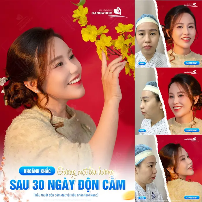 Gương mặt lên hương diện mạo bừng sáng chỉ sau 30 ngày đã hoàn toàn khác biệt 
