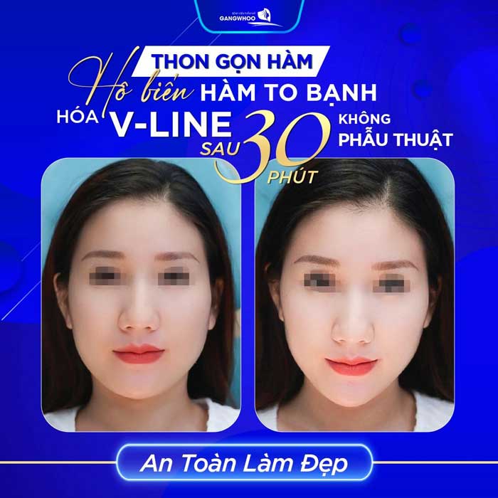 ham ho
