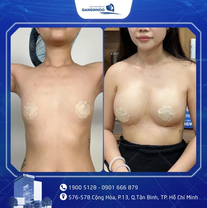 hinh anh khach hang nang nguc 1