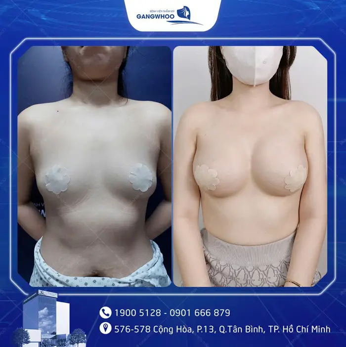 hinh anh khach hang nang nguc 10