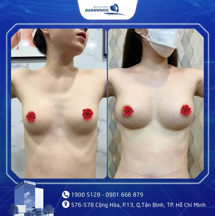 hinh anh khach hang nang nguc 2