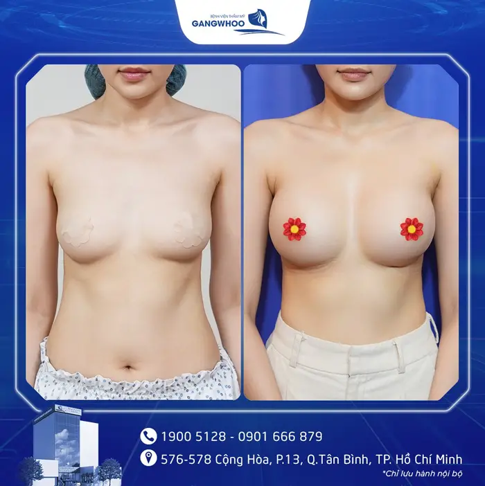 hinh anh khach hang nang nguc 3