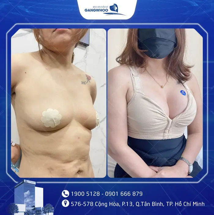 hinh anh khach hang nang nguc 4