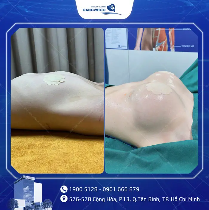 hinh anh khach hang nang nguc 5