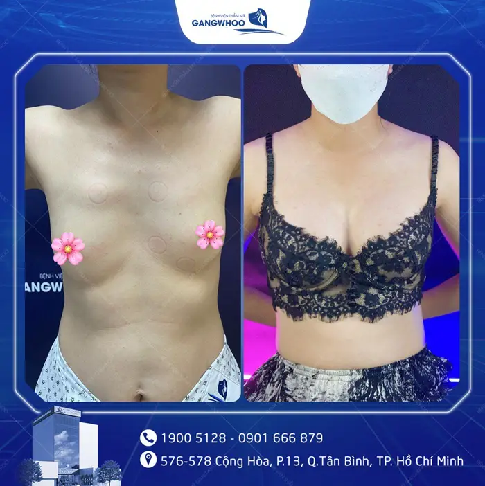 hinh anh khach hang nang nguc 6