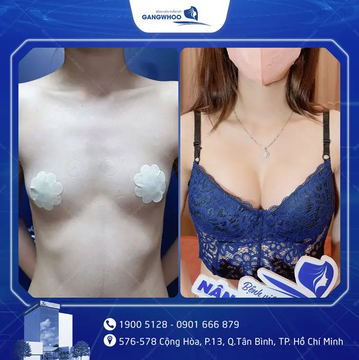 hinh anh khach hang nang nguc 7 1