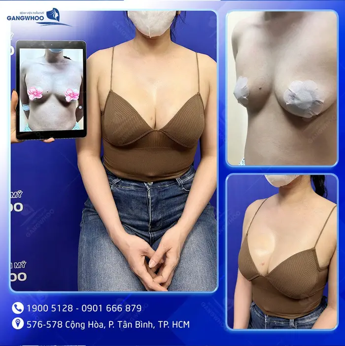 hinh anh khach hang nang nguc 8