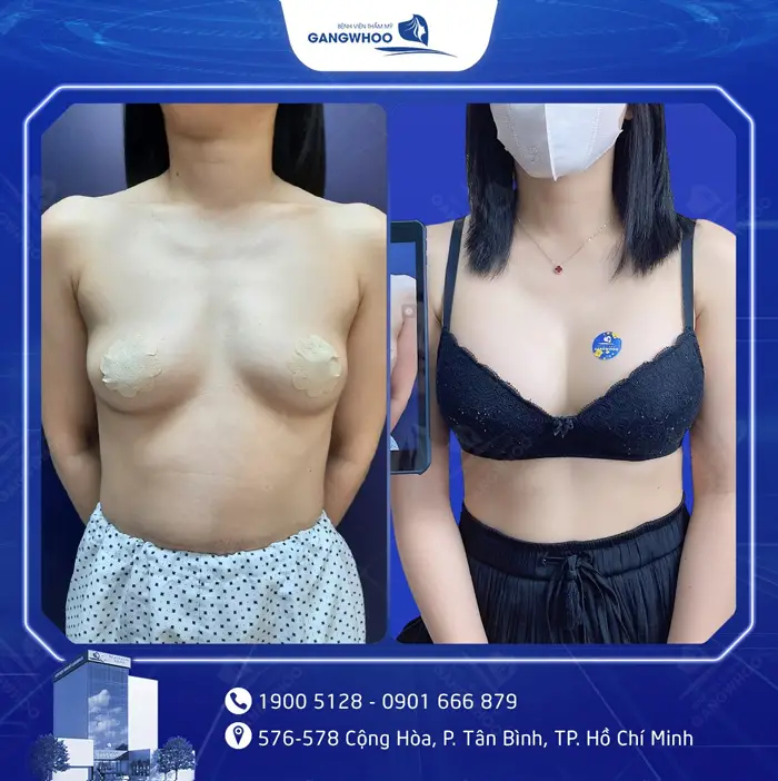 hinh anh khach hang nang nguc 9