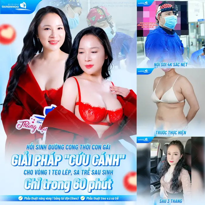 Phẫu Thuật Treo Vú Sa Trễ (Treo Ngực Sa Trễ) Nội Soi 4K Khắc Phục Mọi Cấp Độ Sa Trễ 4 Hồi sinh đường công thời con gái giải pháp cho vòng 1 sa trễ chỉ trogn 60 phút thực hiện