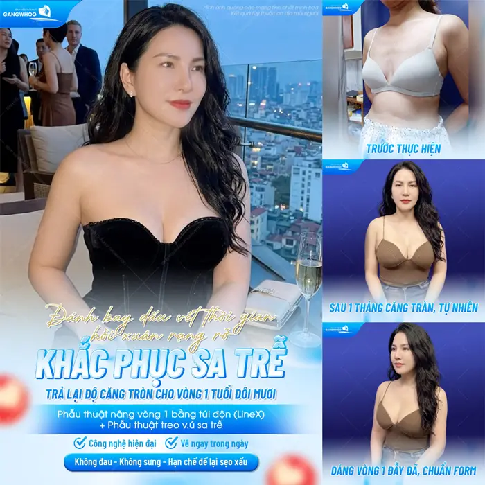Phẫu Thuật Treo Vú Sa Trễ (Treo Ngực Sa Trễ) Nội Soi 4K Khắc Phục Mọi Cấp Độ Sa Trễ 5 Khắc phục sa trễ trả lại độ căng cho vòng 1 tuổi đôi mươi đẹp hấp dẫn và hài hòa so với sắc vóc của cơ thể