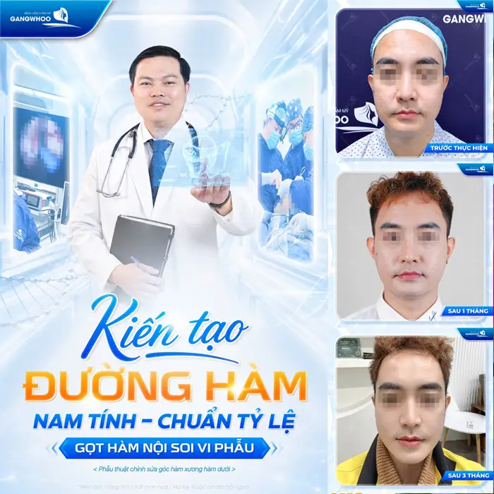 Gọt Hàm Và Điều Chỉnh Trục Xương Giúp Gương Mặt Thon Gọn 4 Kiến tạo đường hàm chuẩn nam tính gương mặt đẹp chuẩn tỷ lệ sau gọt hàm nội soi vi phẫu