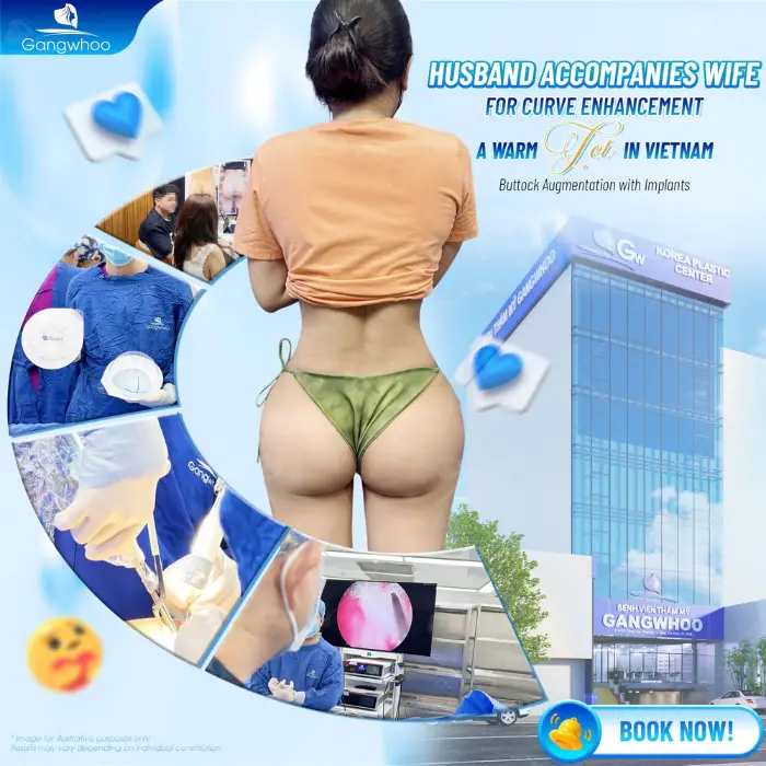 laparoscopic buttocks augmentation