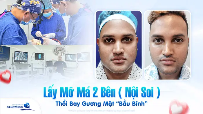lay mo ma 2 ben