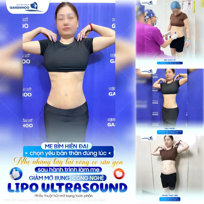 Mẹ bỉm chọn yêu bản thân nhẹ nhàng lấy lại vóc dáng đẹp săn gọn sau hành trình làm mẹ 