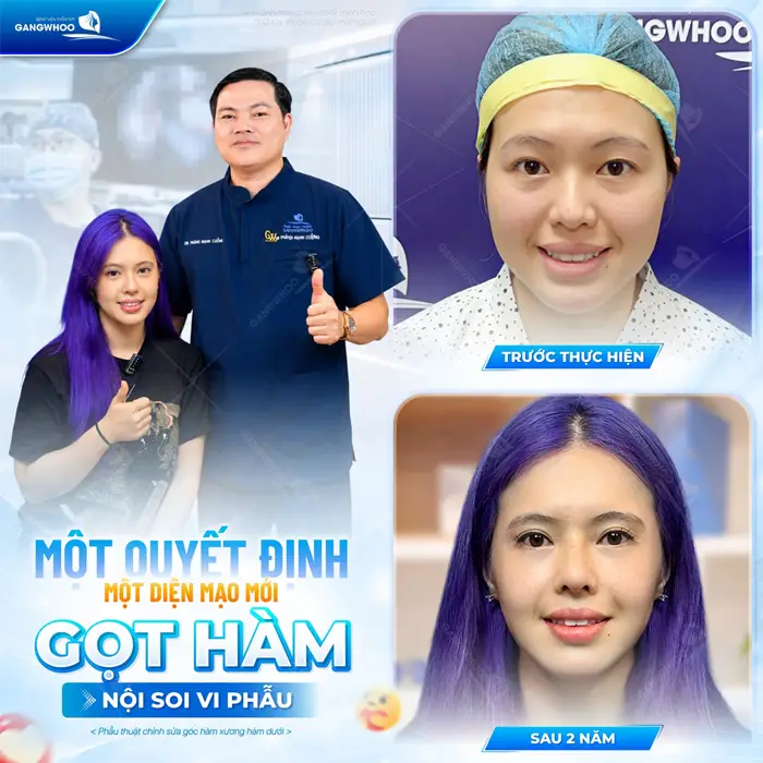 Top 5 Bác Sĩ Gọt Hàm Giỏi Uy Tín Tại TPHCM 6 1 diện mạo mới sau gọt hàm nội soi vi phẫu sau 2 năm nhan sắc diện mạo thay đổi đầy bất ngờ