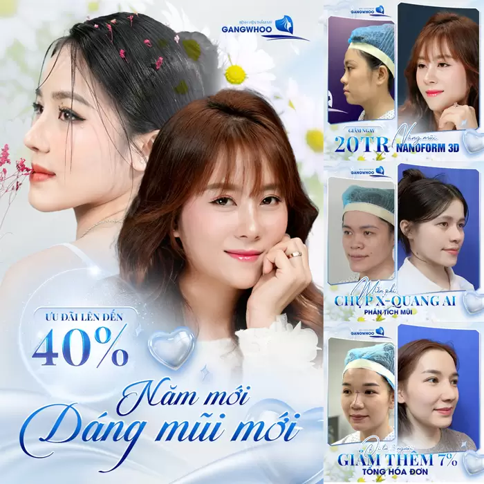 Bảng Giá Phẫu Thuật Thẩm Mỹ Làm Đẹp Tại Bệnh Viện Thẩm Mỹ Gangwhoo 1 nam moi dang mui moi huong nhieu uu dai