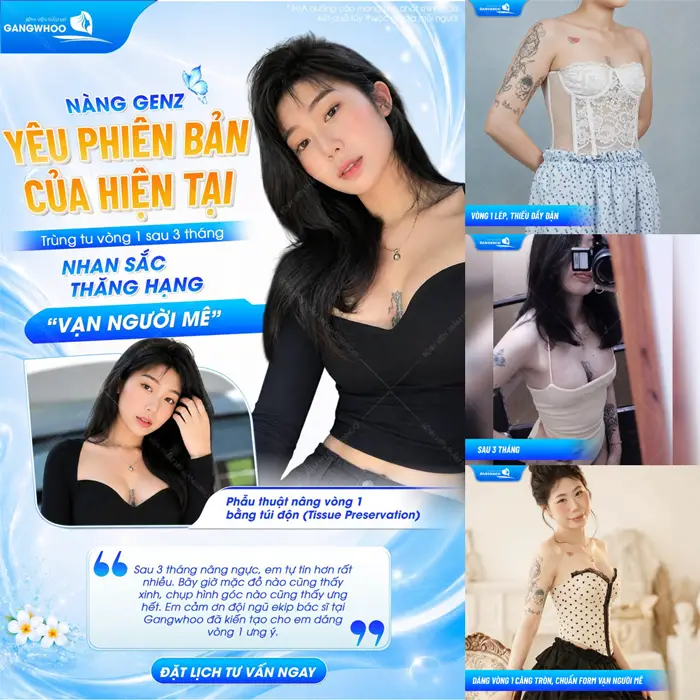 Nâng cấp vòng 1 nâng cấp phiên bản hiện tại thêm thăng hạng nhan sắc đầy cuốn hút và rạng rỡ