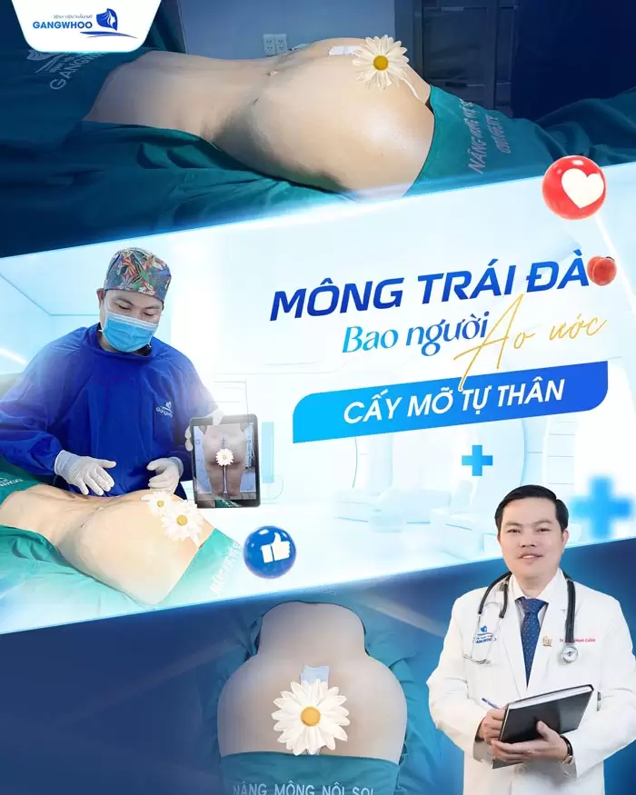 Nâng Mông Bằng Mỡ Tự Thân - "Vòng 3 Quyến Rũ Căng Tròn Ngay Lập Tức" 1 Nâng Mông Bằng Mỡ Tự Thân - "Vòng 3 Quyến Rũ Căng Tròn Ngay Lập Tức"
