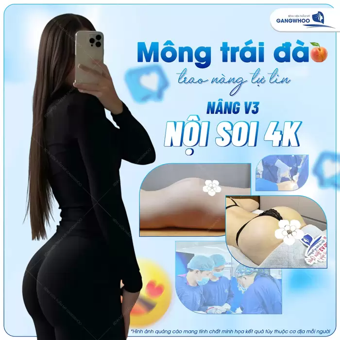 Nâng Mông Nội Soi "Tôn Vinh Vòng 3 Căng Tròn Quyến Rũ" 3 Nâng mông trái đầo trao nàng tự tin sau nâng vòng 3 nội soi 4K tại Gangwhoo