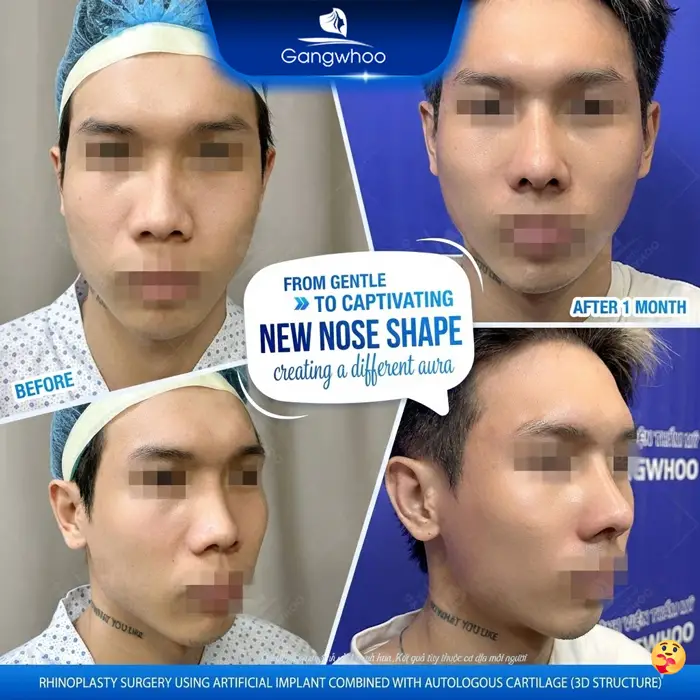 nang mui l line cho nam 1