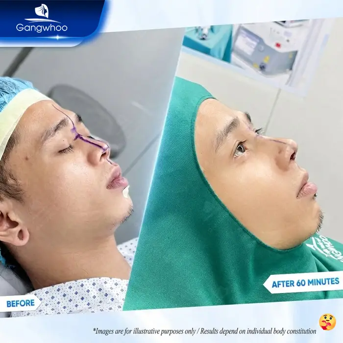 nang mui l line cho nam 5