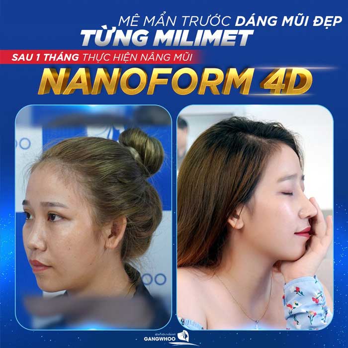 nang mui nanoform 1 2