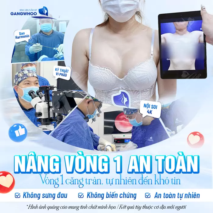 Nâng mũi độn túi an toàn vòng 1 đẹp căng tràn đẹp tự nhiên không lo biến chứng