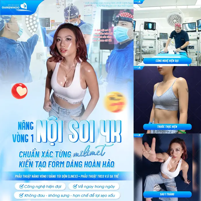Nâng vòng 1 nội soi 4K đẹp chuẩn xác từng milimet giải pháp kiến tạo vóc dáng hoàn hảo 