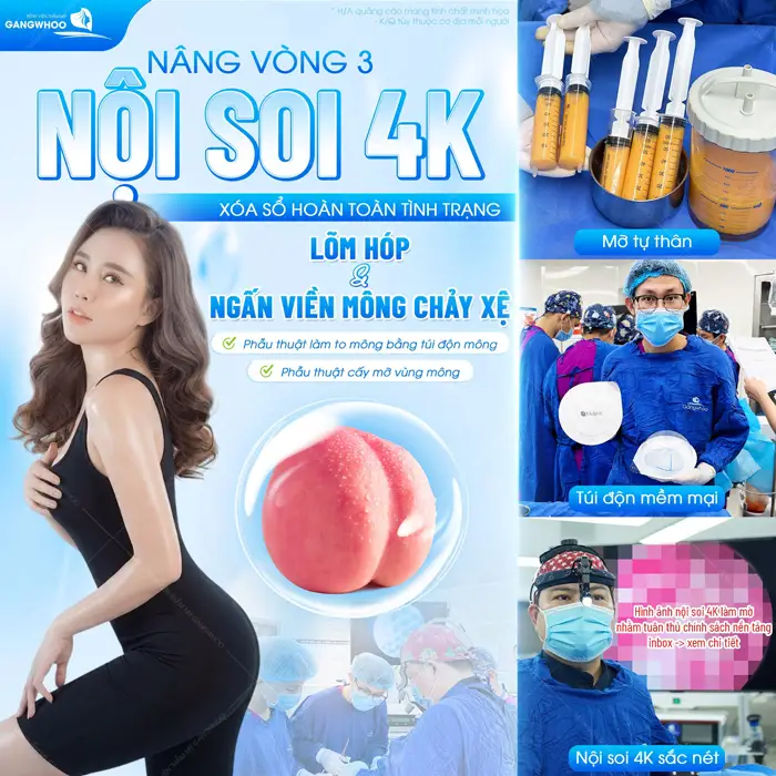 Nâng vòng 3 nội soi 4K xóa sổ hoàn toàn tình trạng mông hóp và lõm với ngấn viền mông chảy xệ hiệu quả