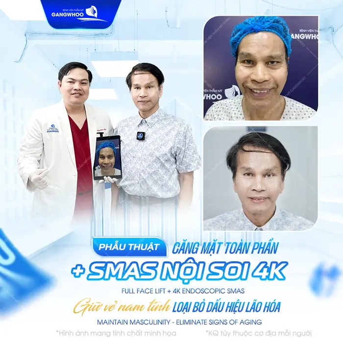 Căng Da Mặt Nội Soi Ở Đâu? 7 Địa Chỉ Uy Tín Tại TPHCM 14 Phẫu thuật căng da mặt toàn phần giữ vẻ đẹp nam tính hiệu quả và dài lâu