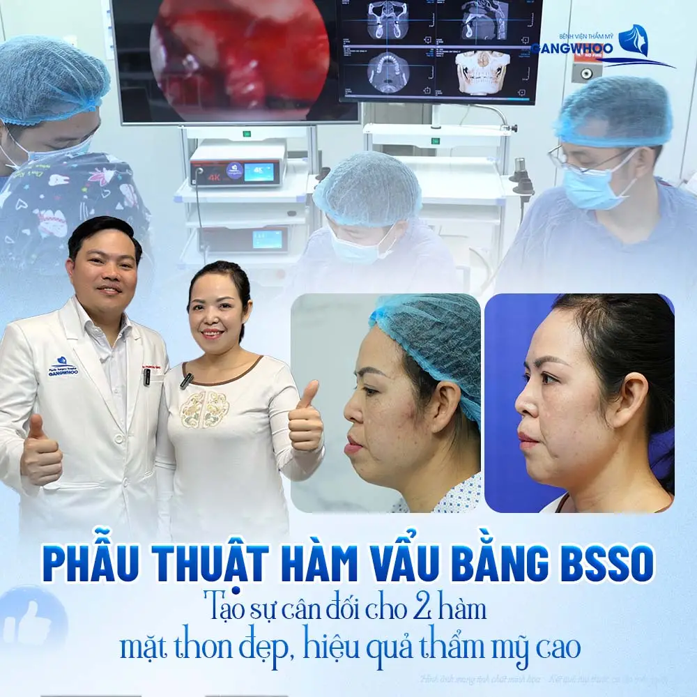 Phẫu thuật hàm vẩu BSSO giải pháp cho sự cân đối, mặt thon đẹp và hiệu quả thẩm mỹ đẹp dài lâu 