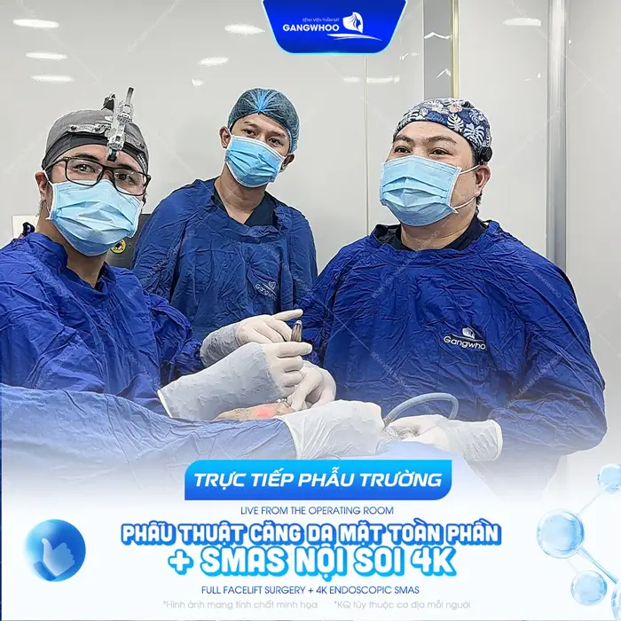 phau truong cang da mat smas 4