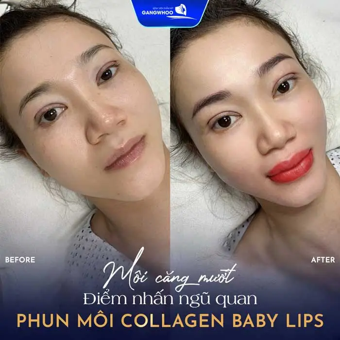 Phun Môi Là Gì? Khác Gì Xăm Môi? Top 9 Màu Hot 2025 3 Phun môi Collagen Baby Lips