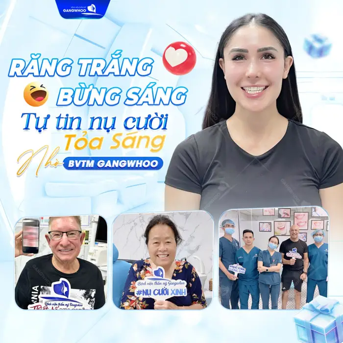 Tẩy Trắng Răng Là Gì? Tẩy Trắng Răng Giữ Được Bao Lâu? 5 Răng trắng bừng sáng tự tin với nụ cười tỏa sáng nhờ BVTM Gangwhoo