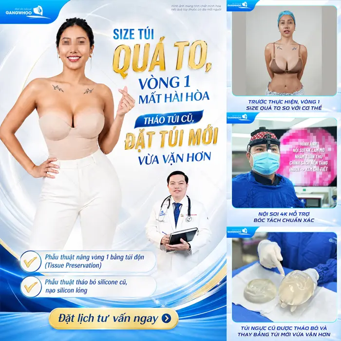 Đặt size túi quá to vòng 1 mất cân đối thu nhỏ vòng 1 lấy lại nét đep vừa vặn và đường cong hài hòa cho cơ thể
