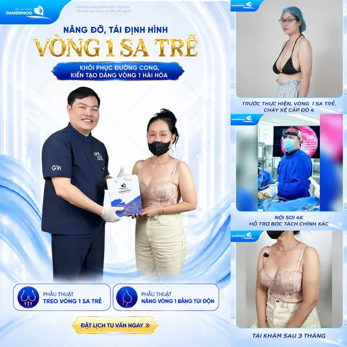 Nâng đỡ và tái định hình vòng 1 sa trễ khôi phục đường cong kiến tạo vóc dáng hài hòa cho cơ thể